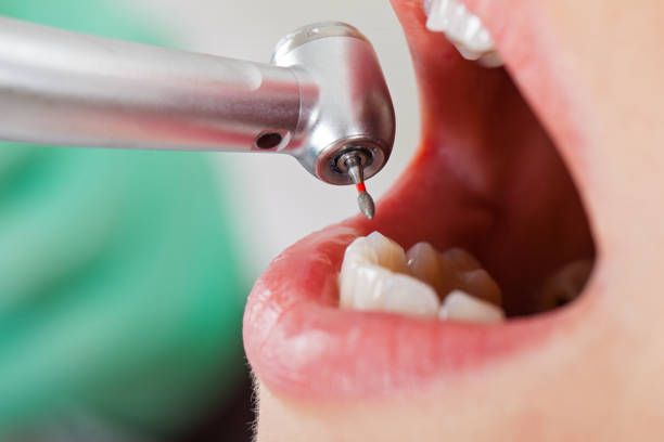 Best Cosmetic Emergency Dentistry in Inglis, FL
